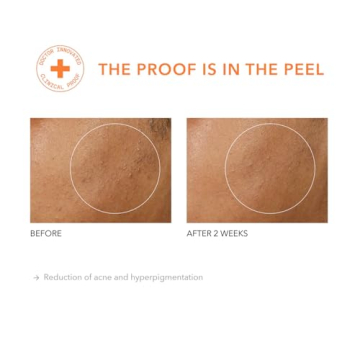 Dr. Dennis Gross Alpha Beta Peel for Youthful Skin