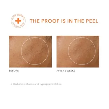 Dr. Dennis Gross Alpha Beta Peel for Youthful Skin