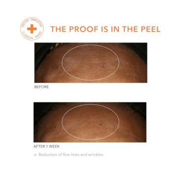 Dr. Dennis Gross Alpha Beta Peel for Youthful Skin