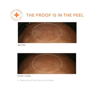 Dr. Dennis Gross Alpha Beta Peel for Youthful Skin