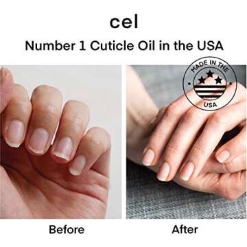 cel MD Cuticle Oil Pen Nail Strengthener Repair Serum – Nail Repair For Damaged Nails – Helps Repair & Nourish Cracked Nails and Rigid Dry Cuticles - Set of 2