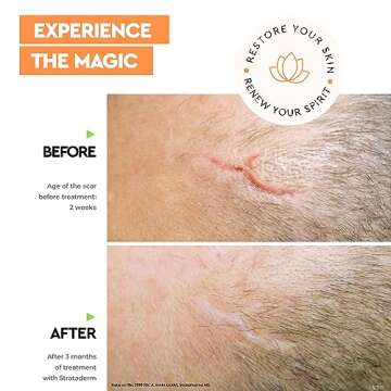 Strataderm Professional Scar Therapy Gel | Old and New Scars from General Surgery, Trauma, Wounds, Burns, Bites, Acne & Skin Disease | Reduces Redness, Discoloration, Discomfort & Itch | 10g (0.35oz)