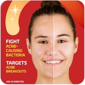 Asepxia Acne Treatment Cream for Face, 2% salicylic acid, Rapid Maximum Strength Acne Treatment, Clears Pimples and Blackheads, Prevents New Acne and Controls Excess Oil, 1 oz