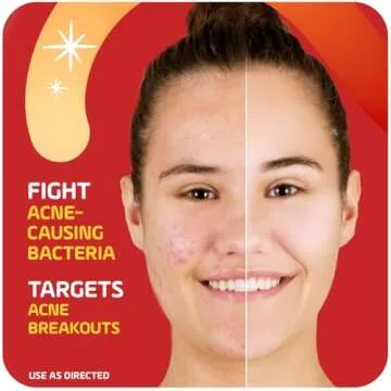 Asepxia Acne Treatment Cream for Face, 2% salicylic acid, Rapid Maximum Strength Acne Treatment, Clears Pimples and Blackheads, Prevents New Acne and Controls Excess Oil, 1 oz