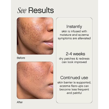 Topicals Like Butter Moisturizer for Eczema Relief and Hydration