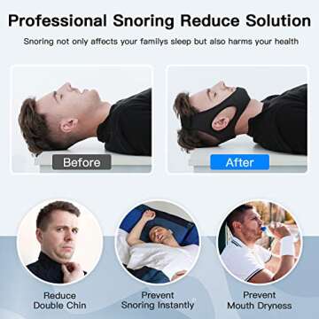 Effective Anti Snore Chin Strap for Men and Women