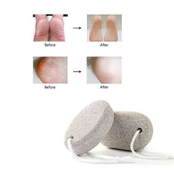 PHOGARY Natural Pumice Stone - 2 PCS for Effective Foot Care