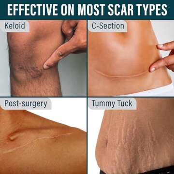 NUVADERMIS Silicone Scar Tape - Medical Grade Solution