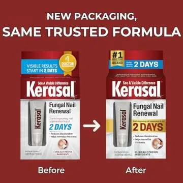 Kerasal Nail Renewal, Restores Appearance of Discolored or Damaged Nails, 0.33 fl oz (Packaging May Vary)