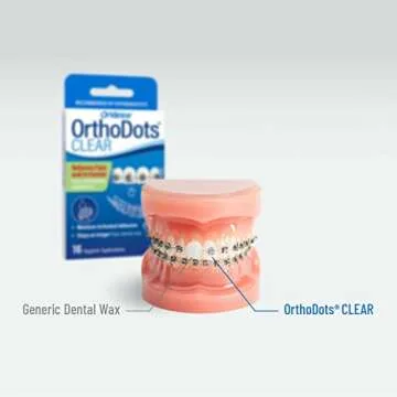 OrthoDots Clear: Moisture Activated Braces Relief Solution