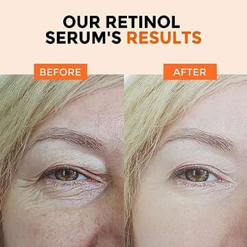 Retinol Serum for Youthful Skin, Anti-Aging & Brightening