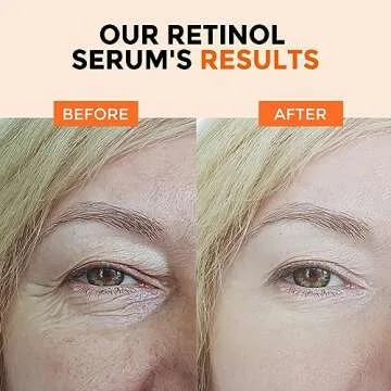 Retinol Serum for Youthful Skin, Anti-Aging & Brightening