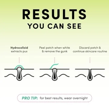 Dots for Spots Pimple Patch - Fast Acting Translucent Hydrocolloid Zit Treatment Stickers for Face - Blemish Patches for Women & Teenage Girls - Made in Korea (24 count)