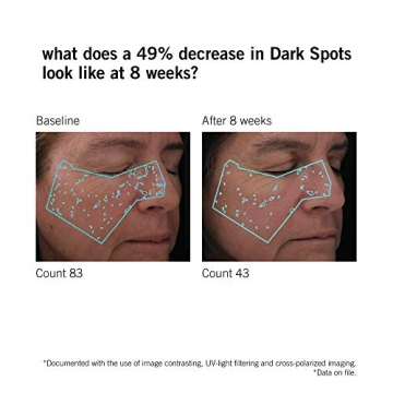 NEOVA DNA Total Repair Serum | Heal Sun Damage & Wrinkles