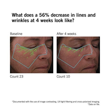 NEOVA DNA Total Repair Serum | Heal Sun Damage & Wrinkles