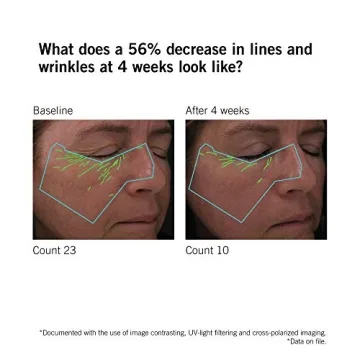 NEOVA DNA Total Repair Serum | Heal Sun Damage & Wrinkles