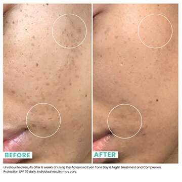 Urban Skin Rx Advanced Even Tone Day & Night Treatment | Exfoliating Cream Visibly Improves the Look of Uneven Skin Tone, Formulated with with 3% Tranexamic Acid and 5% Niacinamide | 1.7 Oz