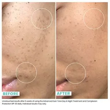 Urban Skin Rx Advanced Even Tone Day & Night Treatment | Exfoliating Cream Visibly Improves the Look of Uneven Skin Tone, Formulated with with 3% Tranexamic Acid and 5% Niacinamide | 1.7 Oz