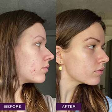 KNOW Beauty Glacial Bay Clay Mask with Canadian Colloidal Clay - Remove Impurities, Tighten Pores, Improve Radiance, Gentle and Hydrating for Acne and Oily Skin - With Lactic Acid and Giant Sea Kelp