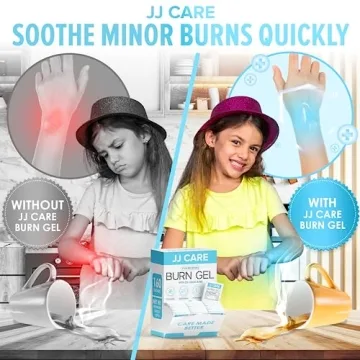 JJ CARE Burn Gel Pack of 160 for Quick Relief