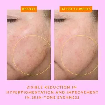 C-Firma Serum by Drunk Elephant - Brightening Face Serum