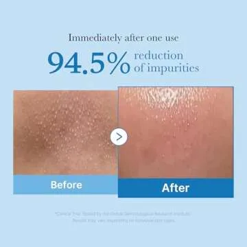 medicube Double Cleanser Duo for Facial Cleansing: Zero Pore Blackhead Deep Cleansing Oil and Zero F...