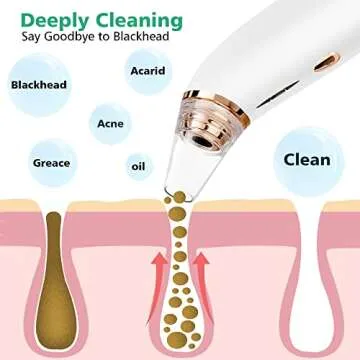 Blackhead Remover Vacuum - TOONZIB Rechargeable Pore Vacuum Blackhead Sucker - Facial Pore Cleaner Tool with 4 Suction Heads & Mud Mask and Argan Oil for All Skin Types - Women & Men