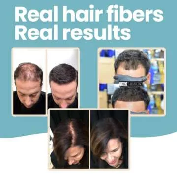 Hair Illusion Dark Brown Real Hair Fibers for Thinning Hair - 100% Natural Texture, Non Synthetic Hair Fibers - Bald Spot Cover Up for Women & Men - 18 Gram