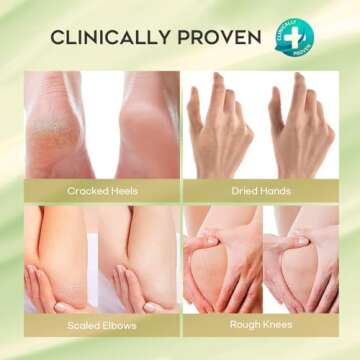 Vebuni Urea Cream 42% Foot Cream Salicylic Acid 4 Oz, Upgraded Callus Remover For Feet, Knees& Elbows, Intensive Moisturizes & Softens Skin, Exfoliates Dead Skin