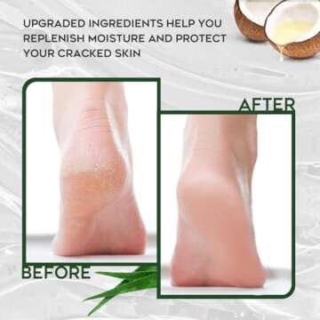 Vebuni Urea Cream 42% Foot Cream Salicylic Acid 4 Oz, Upgraded Callus Remover For Feet, Knees& Elbows, Intensive Moisturizes & Softens Skin, Exfoliates Dead Skin