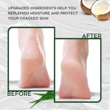 Vebuni Urea Cream 42% Foot Cream Salicylic Acid 4 Oz, Upgraded Callus Remover For Feet, Knees& Elbows, Intensive Moisturizes & Softens Skin, Exfoliates Dead Skin
