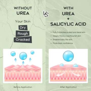 Vebuni Urea Cream 42% Foot Cream Salicylic Acid 4 Oz, Upgraded Callus Remover For Feet, Knees& Elbows, Intensive Moisturizes & Softens Skin, Exfoliates Dead Skin