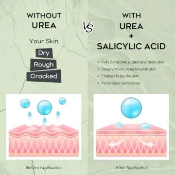 Vebuni Urea Cream 42% Foot Cream Salicylic Acid 4 Oz, Upgraded Callus Remover For Feet, Knees& Elbows, Intensive Moisturizes & Softens Skin, Exfoliates Dead Skin