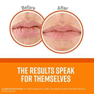 O'Keeffe's Lip Repair Balm for Dry, Cracked Lips, Pack of 4