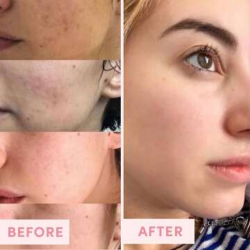 Pink Clay Pore Refining Mask for Clear Skin