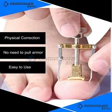 OdontoMed2011 Ingrown Toenail Corrector for Pain Relief