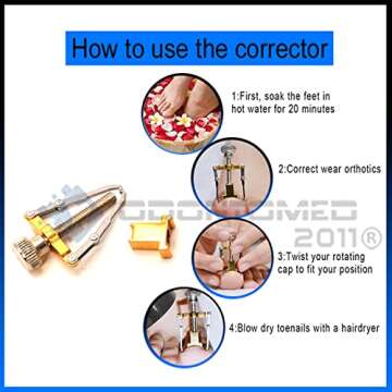 OdontoMed2011 Ingrown Toenail Corrector for Pain Relief