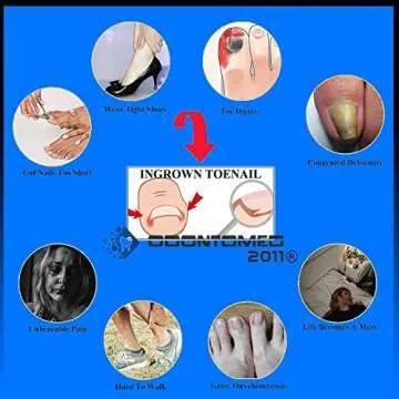 OdontoMed2011 Ingrown Toenail Corrector for Pain Relief
