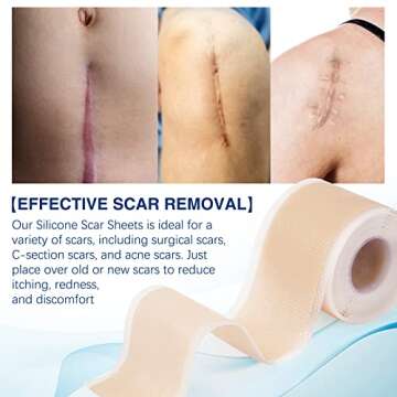 Silicone Scar Sheets (1.6”x 130”, 3.3M), Professional Silicone Scar Tape, Silicone Scar Strips, Reusable Scar Removal Sheets for Surgical Scars, C-Section, Surgery, Burn, Keloid, Acne