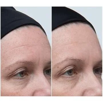 Kreyol Essence - Haitian Moringa Oil 15 Ml - For Face, Hair and Body, 40 Antioxidants, Behenic, Oleic Acid and Vitamin C, For All Skin Types, Natural Ingredients