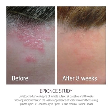 Epionce Medical Barrier Cream 8 oz for Intense Hydration