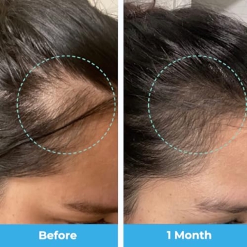 Baby Blues Postpartum Hair Vitamins Gummies for Moms