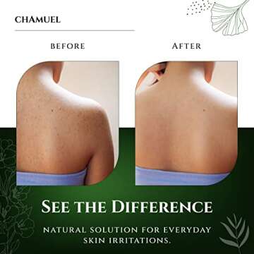 Chamuel Tea Tree Body Wash - Made With Natural Ingredients To Fights Itchy Skin, Body Odor, Athlete's Foot, Jock Itch & Toenails Issues - Organic Scented - Men & Women (11.8oz)