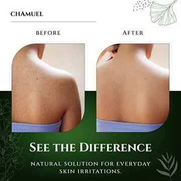 Chamuel Tea Tree Body Wash - Made With Natural Ingredients To Fights Itchy Skin, Body Odor, Athlete's Foot, Jock Itch & Toenails Issues - Organic Scented - Men & Women (11.8oz)