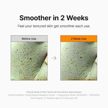 Gentle Exfoliating Toner with Mandelic Acid for Sensitive Skin