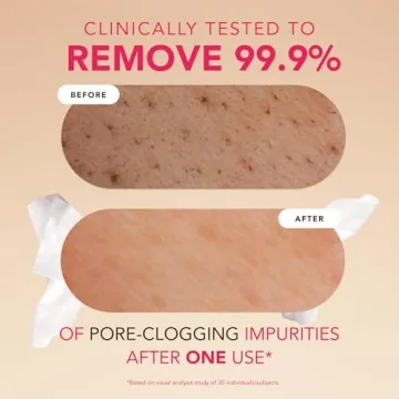 Ultimate Makeup Removal Wipes with Rice Water Care