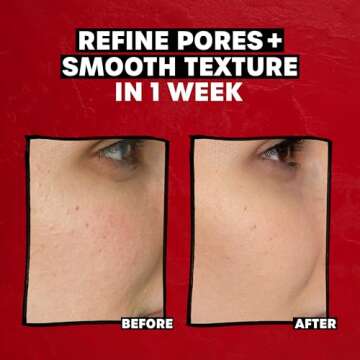 Thayers 2% AHA Exfoliating Toner with Glycolic Acid, Lactic Acid and Witch Hazel, Smoothing and Pore Refining Skin Care for All Skin Types, 12 Fl Oz