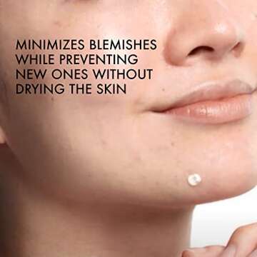 Vichy Normaderm S.O.S Acne Rescue Spot Corrector, 10% Sulfur & Glycolic Acid & Niacinamide, Blackhead Remover & Acne Spot Treatment For Face, Helps Clear & Prevent, Paraben & Oil Free