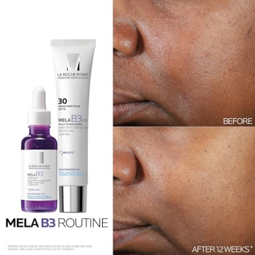 La Roche-Posay Mela B3 Serum for Dark Spots & Anti-Aging