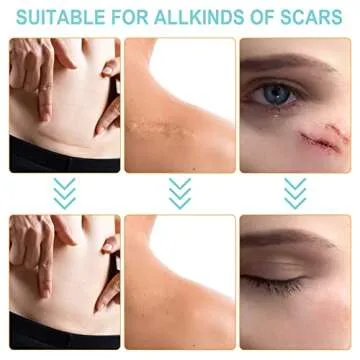 Advanced Silicone Scar Sheets for Effective Treatment